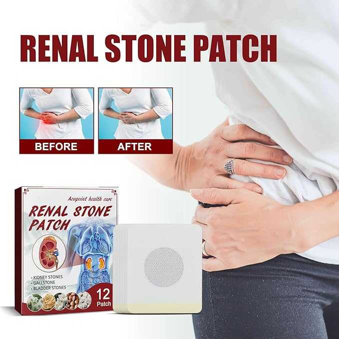 Renal Stone Patch