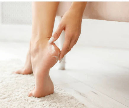 Rose Berry - Callus Therapy Remover Cream