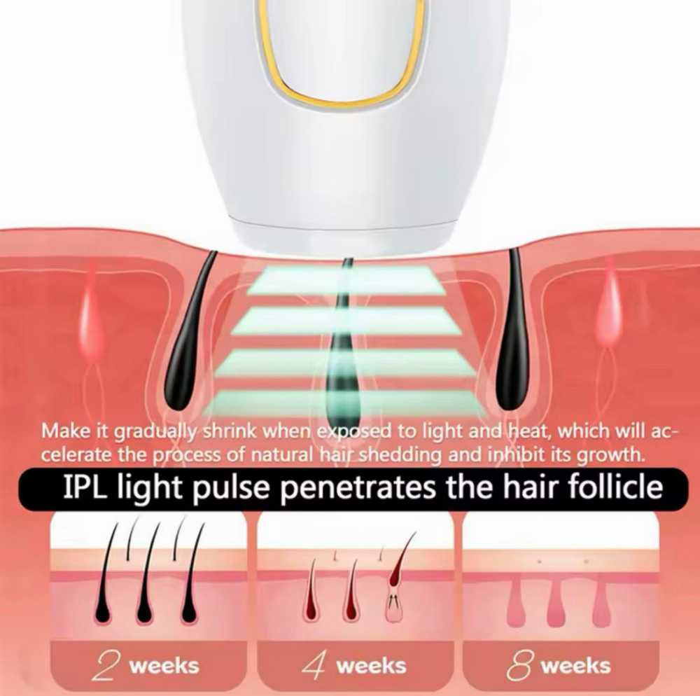 IPL Laser Hair Removal