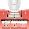 IPL Laser Hair Removal