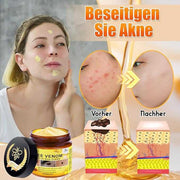 Bee Venom Comprehensive Cream