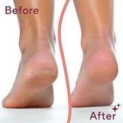 Callus Remover