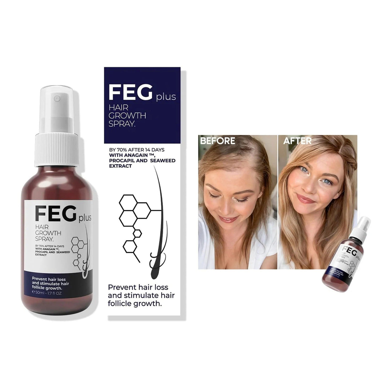 FEG Plus Hair Growth Spray  – Anti Hair Loss for Men & Women