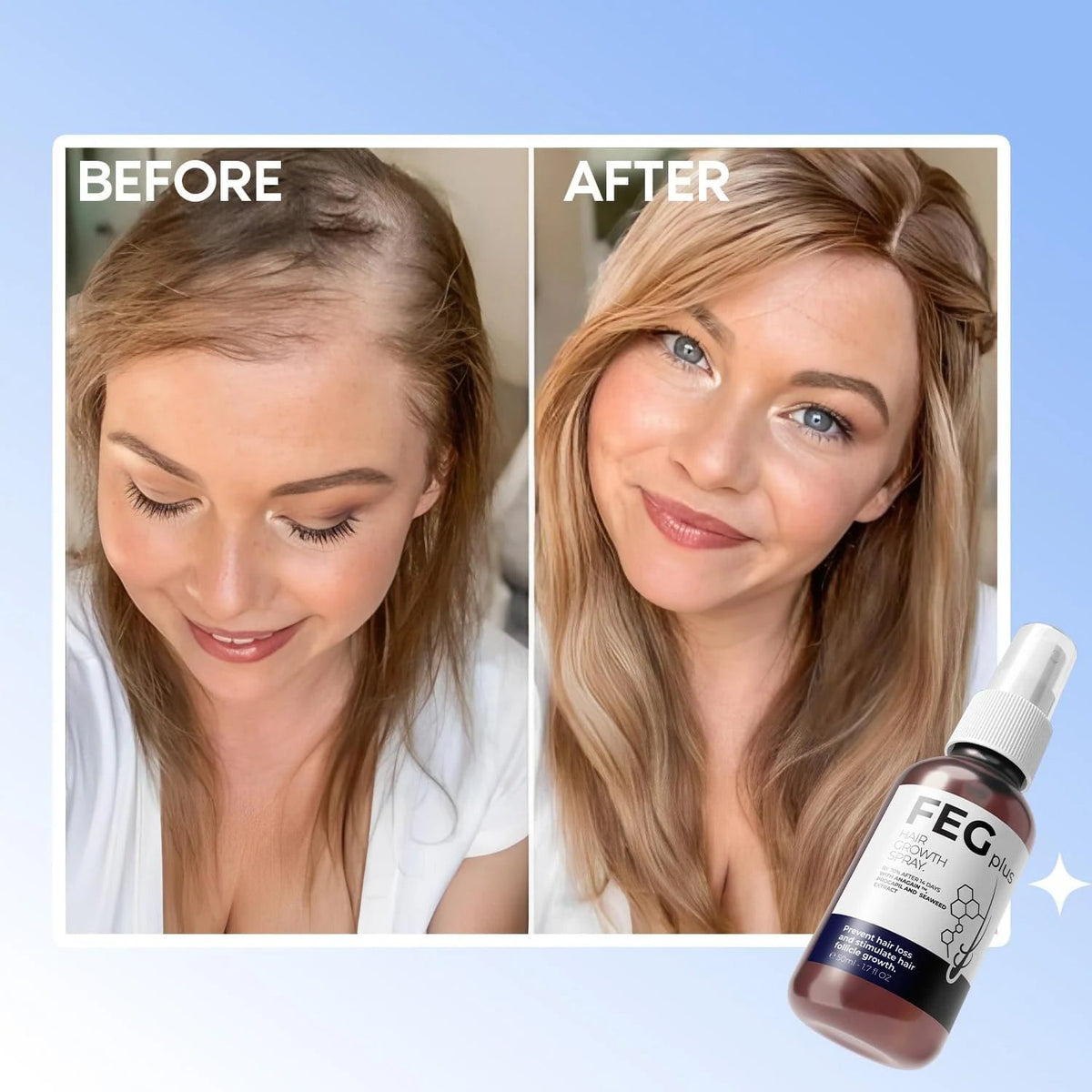 FEG Plus Hair Growth Spray  – Anti Hair Loss for Men & Women