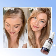 FEG Plus Hair Growth Spray  – Anti Hair Loss for Men & Women