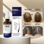 FEG Plus Hair Growth Spray  – Anti Hair Loss for Men & Women