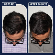 FEG Plus Hair Growth Spray  – Anti Hair Loss for Men & Women