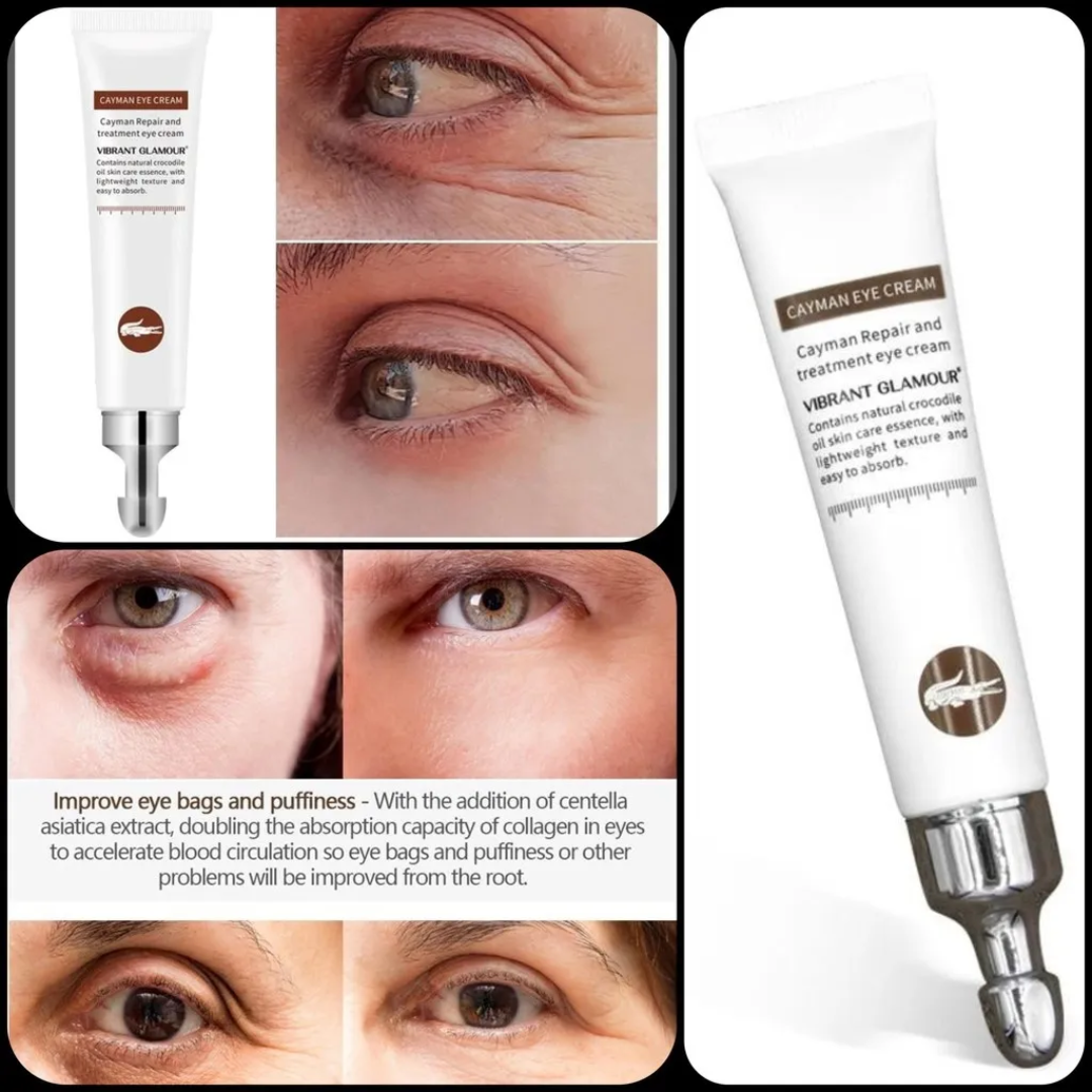 Cayman Eye Cream Dark Circles Anti Rugas Bolsas Corrector De Ojeras Olheiras Antiojeras Olhos Ojos Antiarrugas Arrugas Cerne