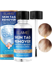 Skin Tag Remover