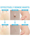 Skin Tag Remover
