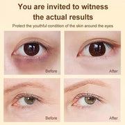 Anti-Wrinkle Essential Oil with VC & Lutein