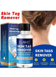 Skin Tag Remover