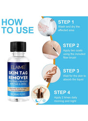 Skin Tag Remover