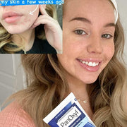 PanOxyl - Acne Creamy Wash 170g